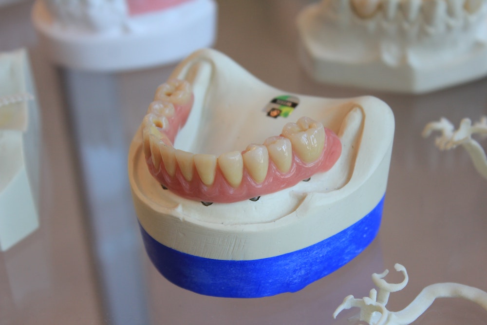 Denture Adhesive Removal  