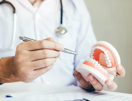 How Often Do Dentures Need to Be Relined?