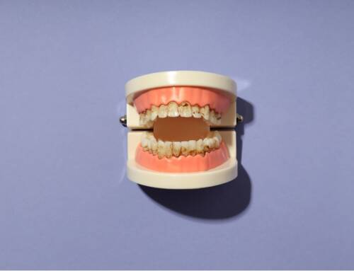 Rotting and Breaking Teeth? You’re Not Alone
