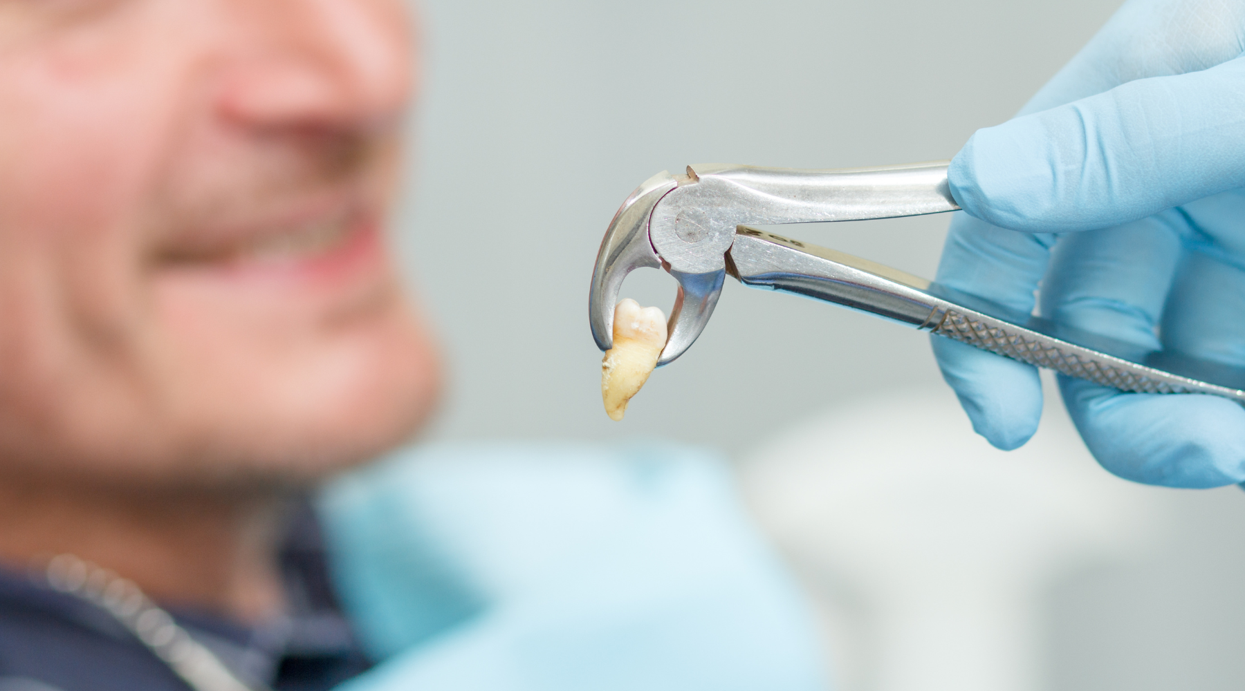Tooth Extraction Cost and Denture Options Tooth Extraction Cost and Denture Options