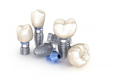 tooth replacement options