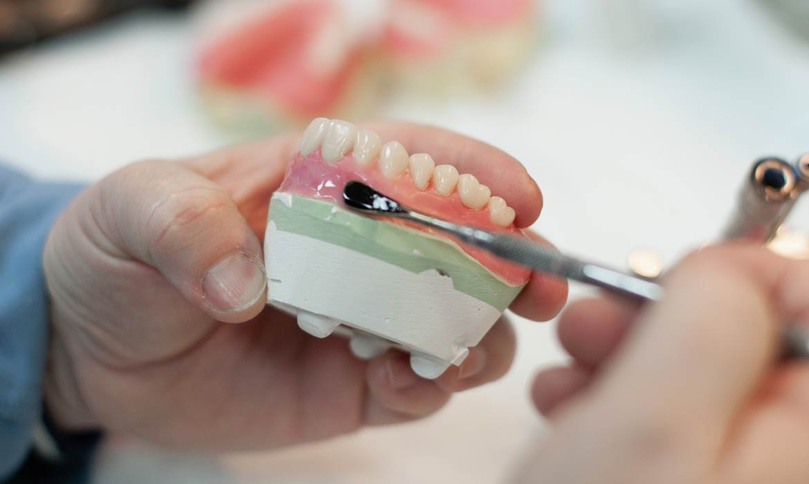Best Denture Making Materials Porcelain Vs Acrylic