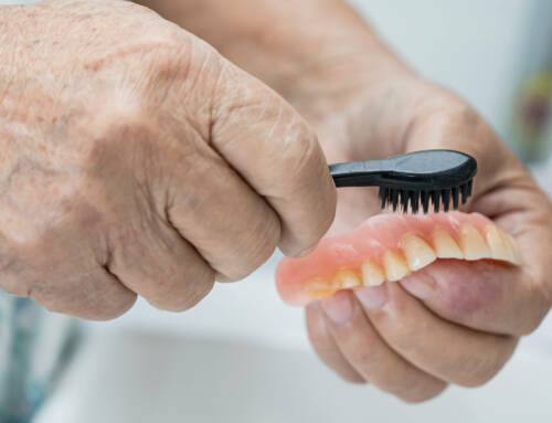 Types of Removable Partial Dentures