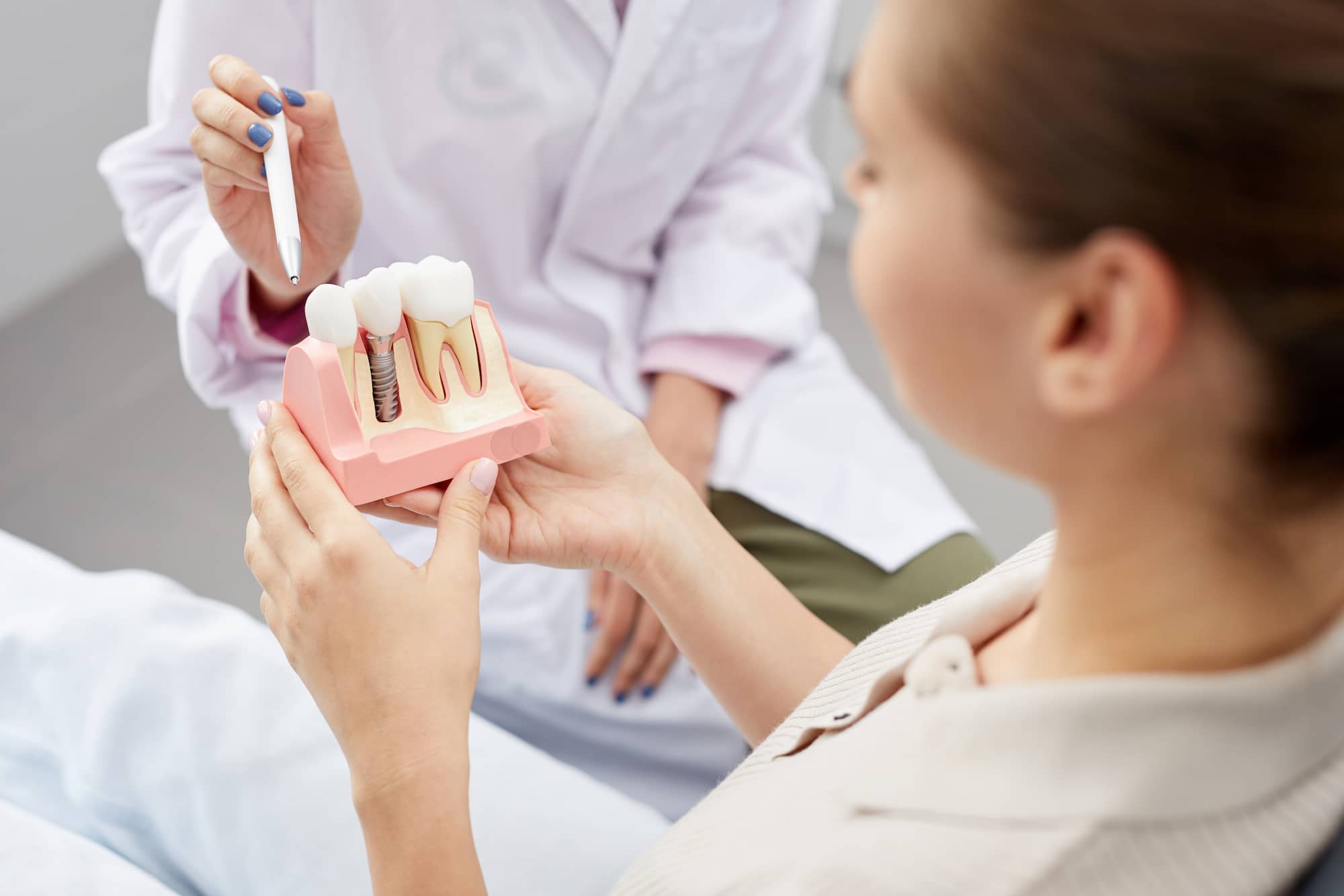 Dentist showing broken dental implant to patient.