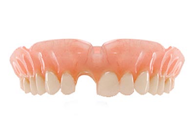 Partial dentures