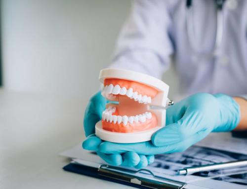 Prepare for Dentures: The Denture Process Start to Finish