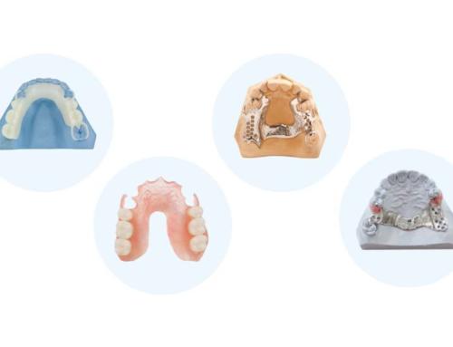 Different Types of Partial Dentures