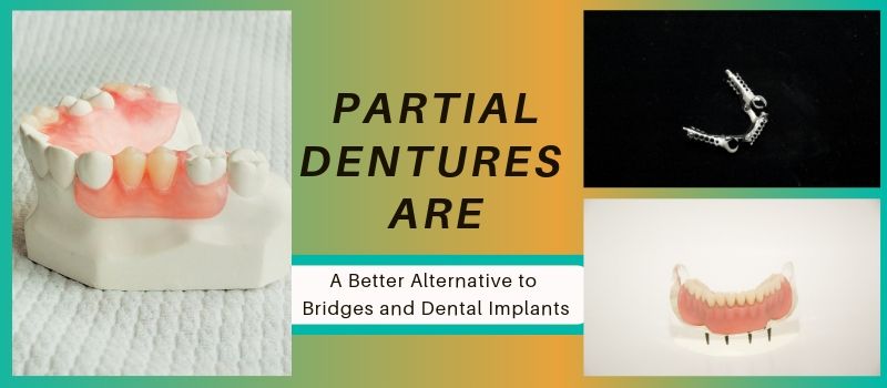 partial dentures