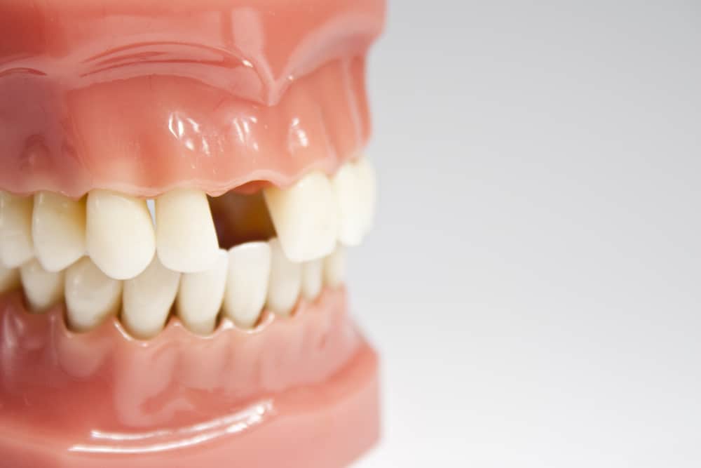 Several Methods of Teeth Repair