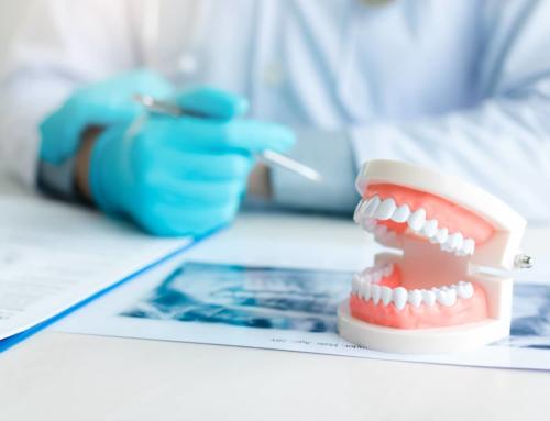 How to Pay for Dental Implants: Implant Financing Options