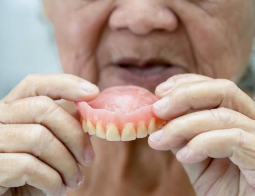 Is Wearing Dentures 24/7 OK? 6 Things to Know